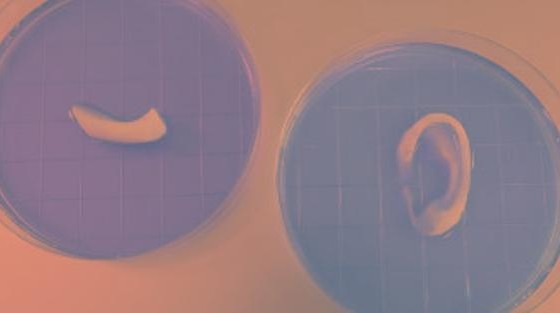 3D-биопринтер позволяет создать уши, мышцы и костную ткань